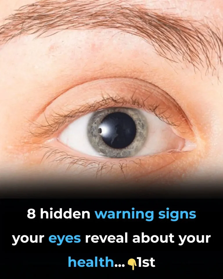 8-eye-symptoms-that-could-signal-a-serious-health- cover