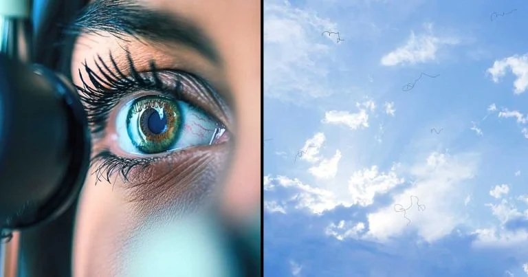 eye-floaters-the-3-symptoms-that-mean-you-need-urg cover