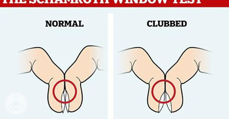 the-simple-finger-test-that-could-flag-lung-cancer-cover the-simple-finger-test-that-could-flag-lung-cancer cover