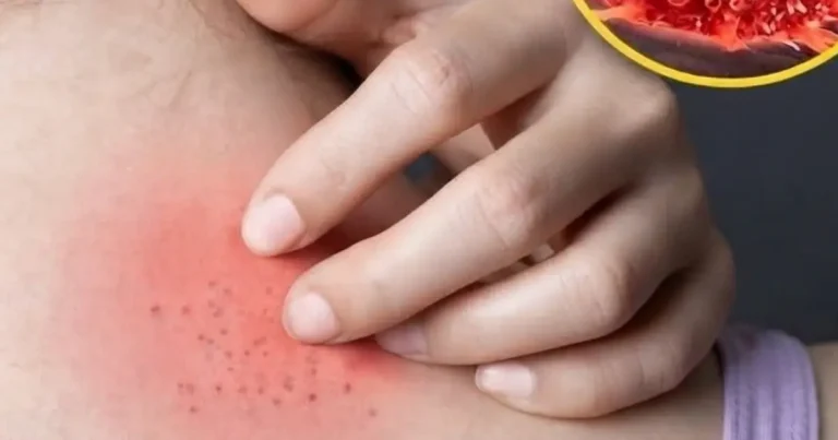 9-types-of-persistent-itching-that-could-signal-a- cover