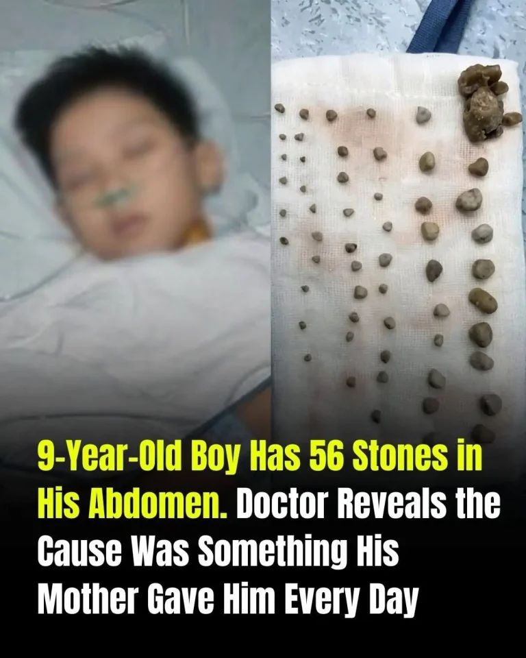 kidney-stones-in-children-the-daily-habits-that-re cover