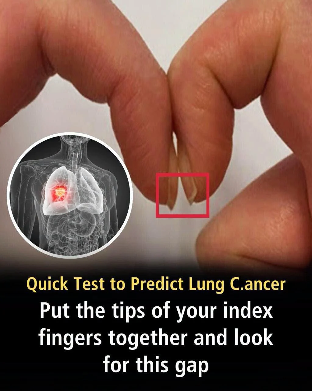 The simple finger test that could flag lung cancer risk cover